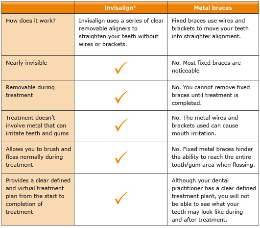 Invisalign near me v Braces Chart