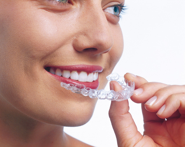 Invisalign near me Watford at Senova Dental