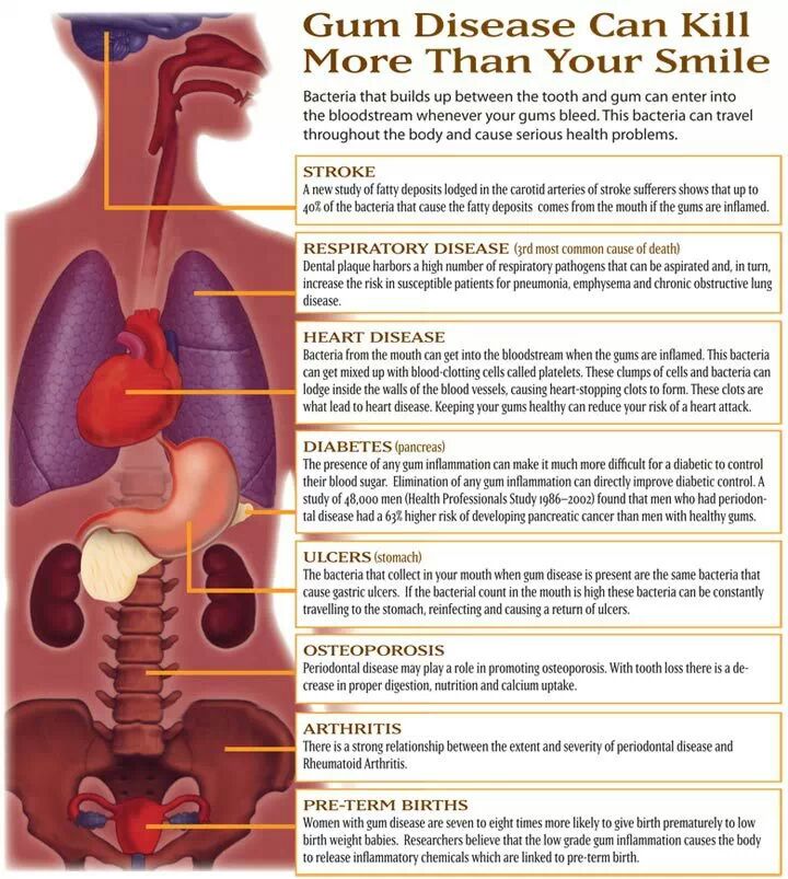 The importance of looking after your teeth