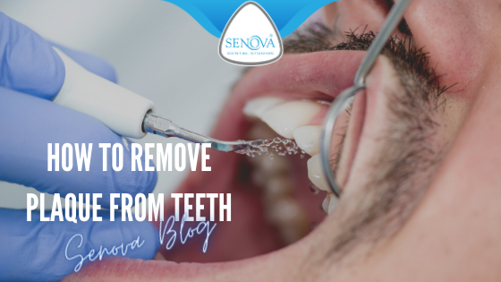 How to remove plaque from teeth