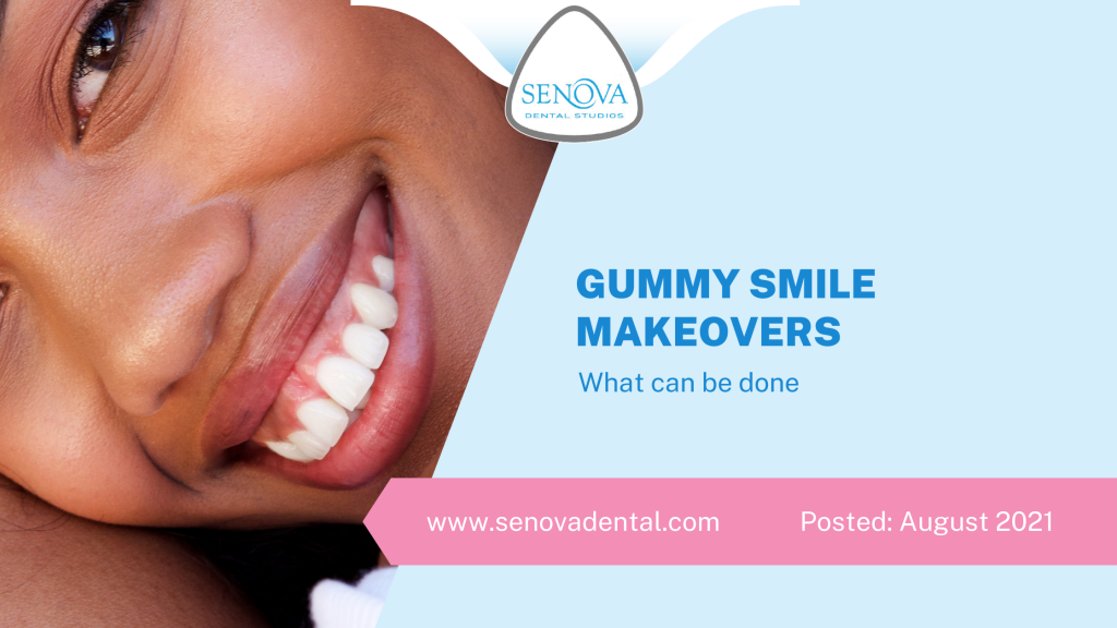 Gummy Smile Makeovers - What Can Be Done?