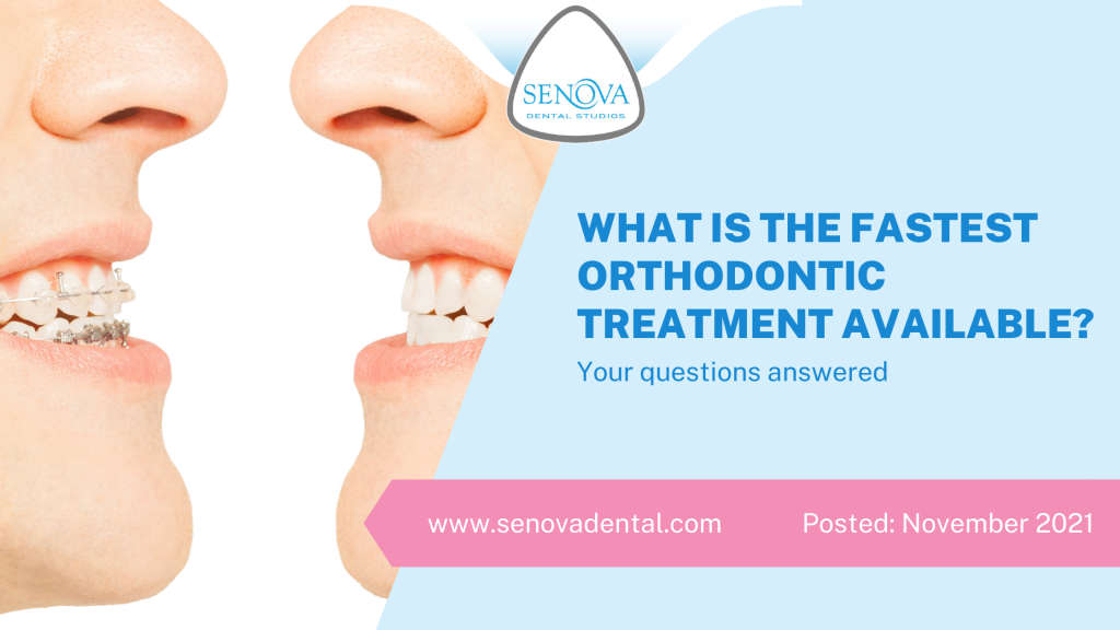 What Is The Fastest Orthodontic Treatment Available?