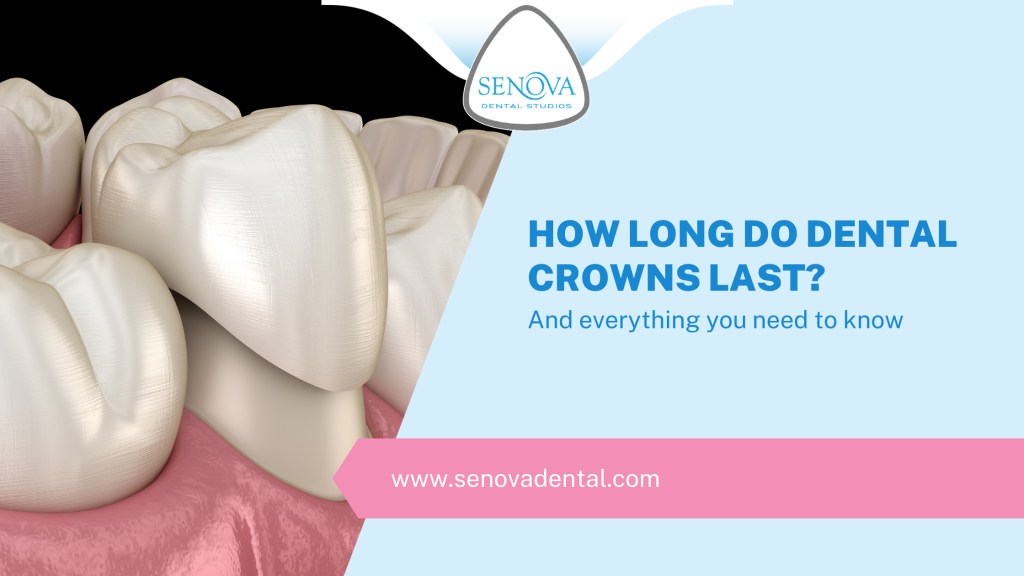 How Long Do Dental Crowns Last?