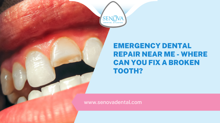 Emergency Dental Repair Near Me - Where Can You Fix A Broken Tooth?