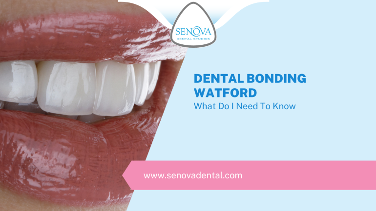 Dental Bonding Watford