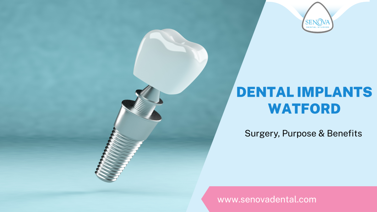 Dental Implants Watford: Surgery, Purpose & Benefits